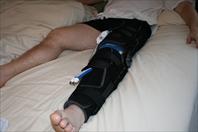 Laura taking off the bandages and re-dressing my knee after my surgery.