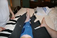 Laura taking off the bandages and re-dressing my knee after my surgery.