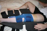Laura taking off the bandages and re-dressing my knee after my surgery.